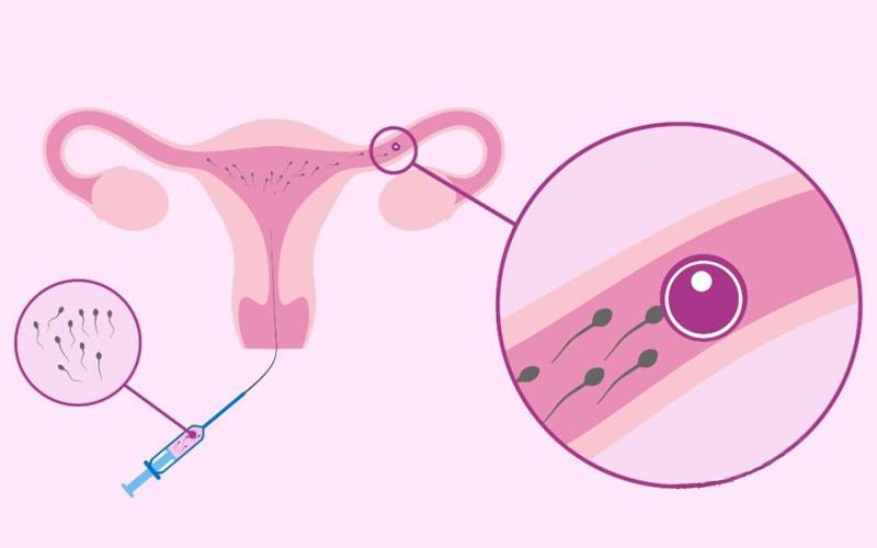 卵巢早衰会怀孕吗，试管怀孕几率有多少？